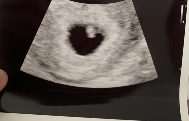 Due February 2025 - Thread 2