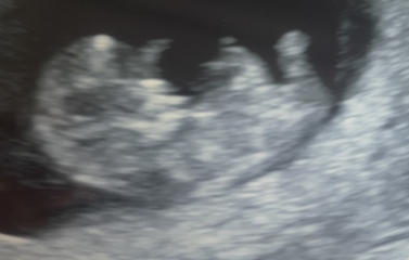 Boy or girl ?