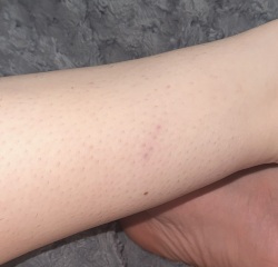 What is this??? - health
