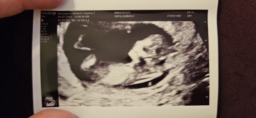 12 week scan, boy or girl? (Just for fun!)