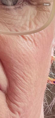 I'm confused, dermatica/skin & me