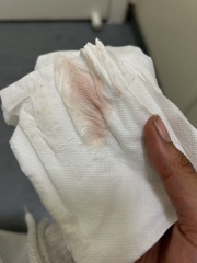 Is this implantation bleeding or my period?