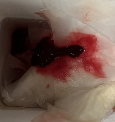 Period clots !!?