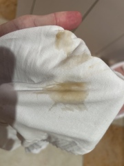 To go to A&E over this? (9 weeks, no EPU here)  *MNHQ ADDING CONTENT WARNING FOR PHOTO*