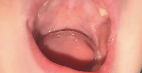 4.5y old twitchy at night