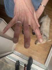 Possible broken index finger