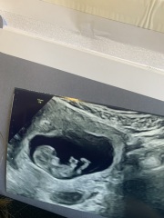 Gender guesses for fun?!