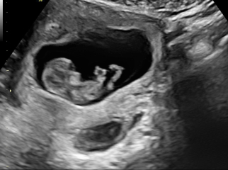 Due February 2025 - Thread 2