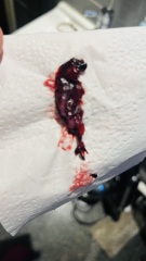 Possible miscarriage? 6 weeks 4 days