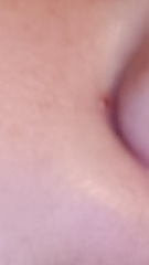 What is this spot that comes up every evening and goes down overnight??  On my face.