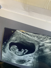 Due February 2025 - Thread 2