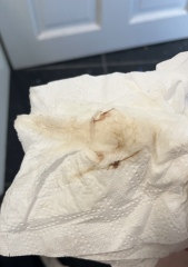 SENSITIVE PIC.. does this look like implantation bleeding either 11/12 dpo