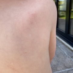 Really strange rash please can anyone help?!