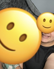 Honest thoughts on my smile