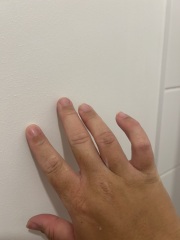 Does this look like bad fake tan?