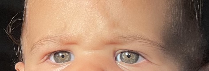 Eye colour