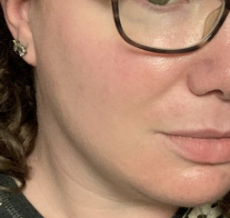 I'm confused, dermatica/skin & me