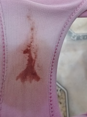 Is this implantation bleeding or just spotting?
