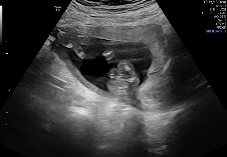 confirmations on my scan help please