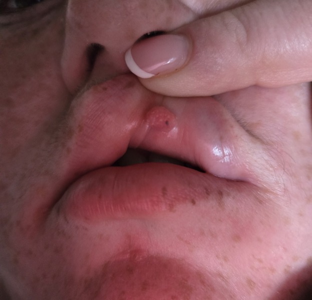 Growth on inner lip, to revisit GP? Pic included