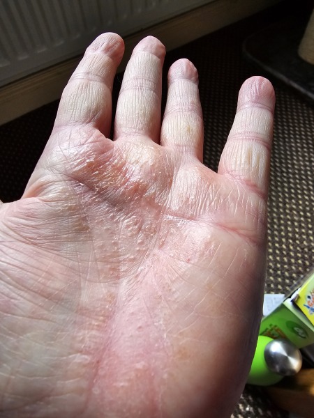 Any idea what this is on my hand? (Photo)