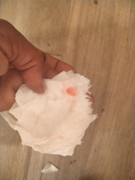 Implantation bleeding 9dpo