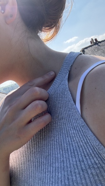 Moveable  lump in side of neck