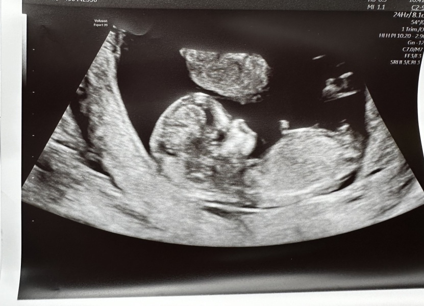 Gender guesses please!