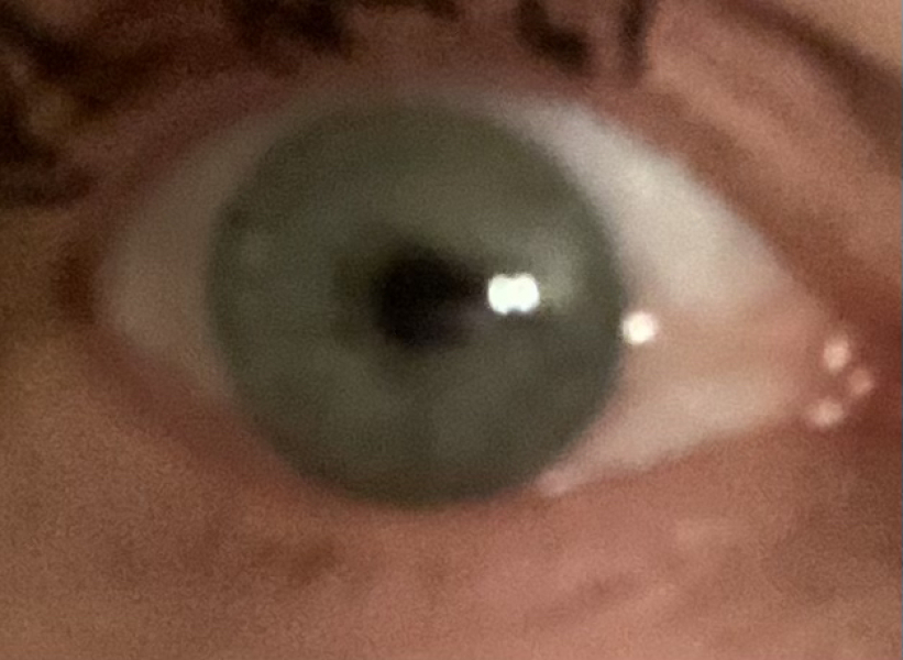 What colour is this eye?