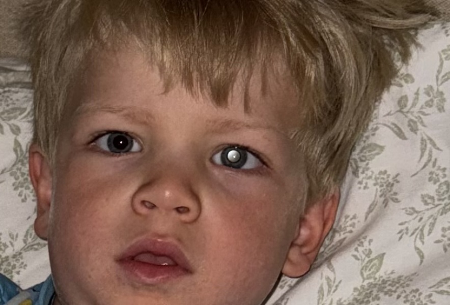 Worried! Help! Toddlers eye/ any ophthalmologists!?