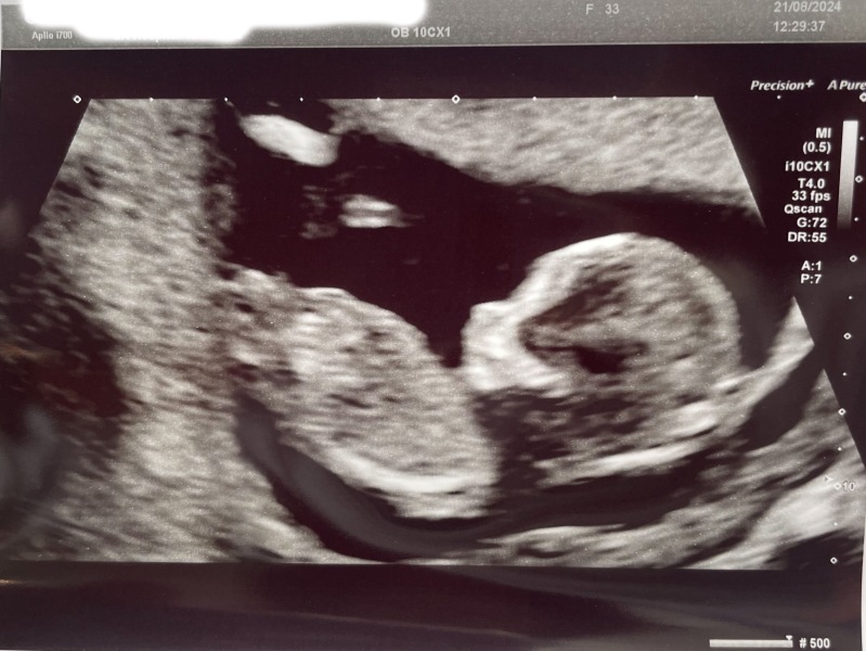 Due February 2025 - Thread 3