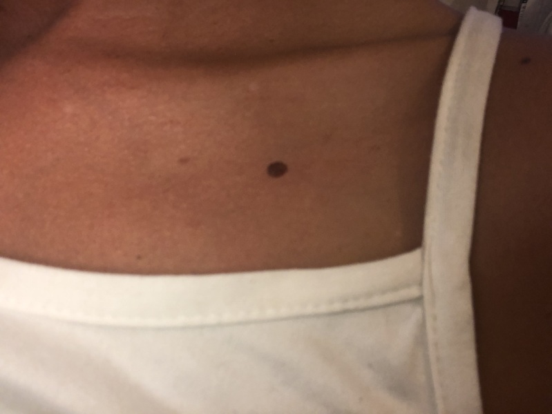 Moles