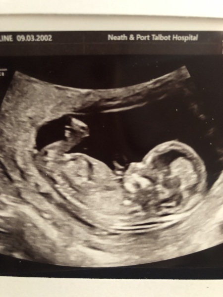 20 scan tomorrow- gender guesses
