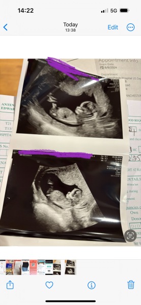 Do you think I’m having a boy or girl?
