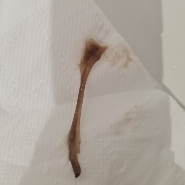 Advice wanted *graphic image* (title edited by MNHQ)