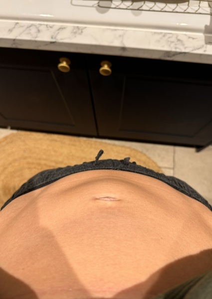 Tummy changes 11th week of pregnancy!