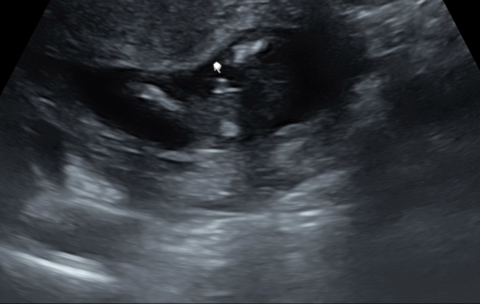 Gender scan - is it correct?