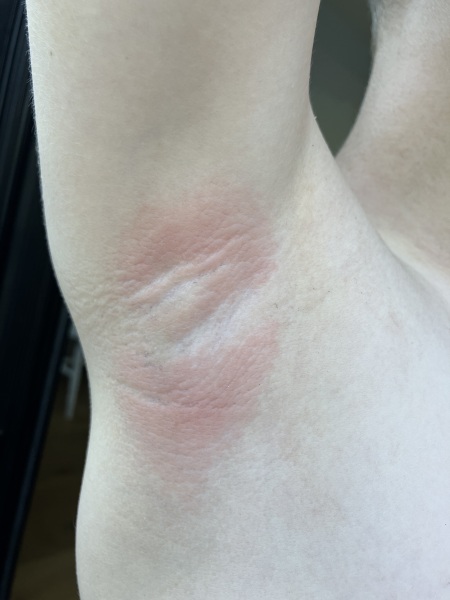 Antiperspirant recs for 9 year old boy?