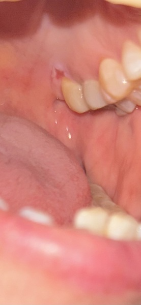 Help - dentists? Should I be worried about this?