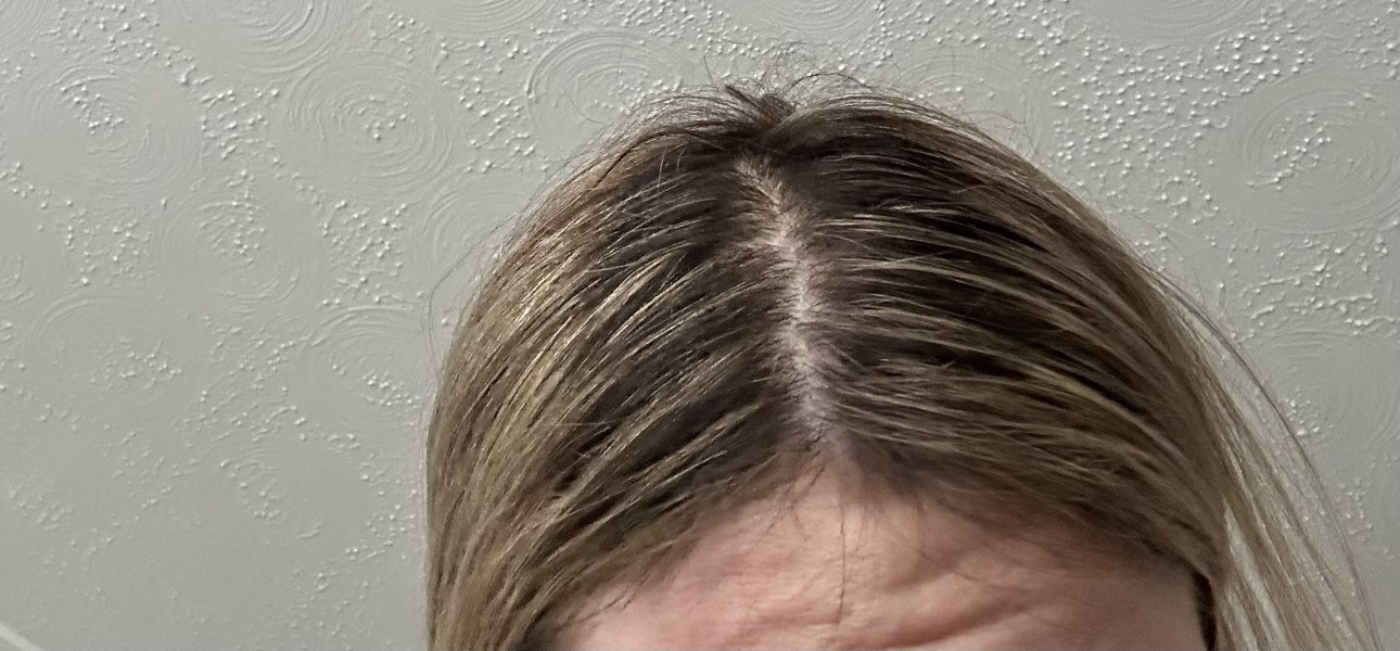 Has hairdresser done a rubbish job?