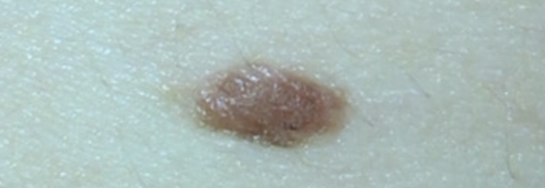 Mole