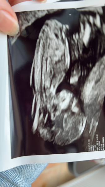 Due February 2025 - Thread 2