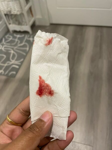 11 weeks 5 days pregnant having bleeding