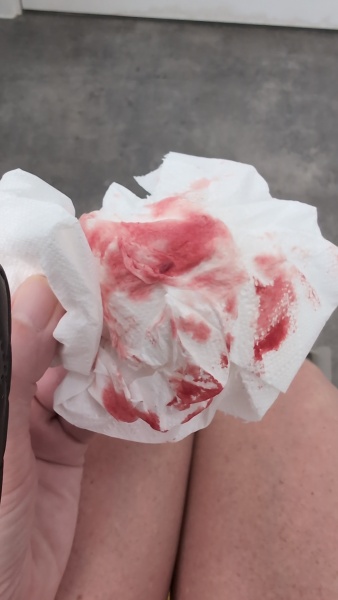 Help is this implantation bleeding