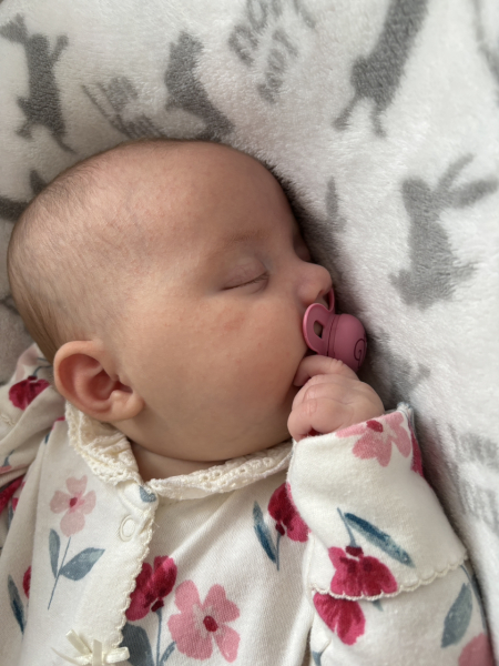 Baby acne?