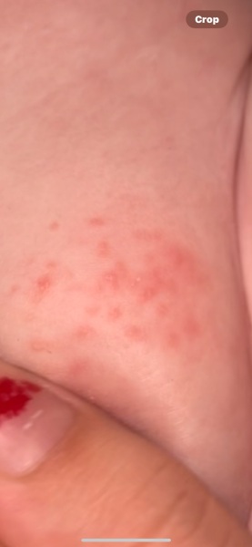Weird rash