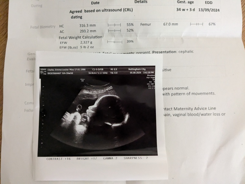 Sept 2024 - Thread 9!