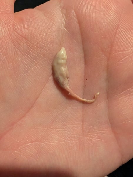 Passing tissue! Warning- image attached