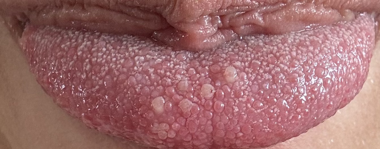 What is wrong with my tongue ?