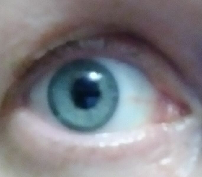 What colour are these eyes?
